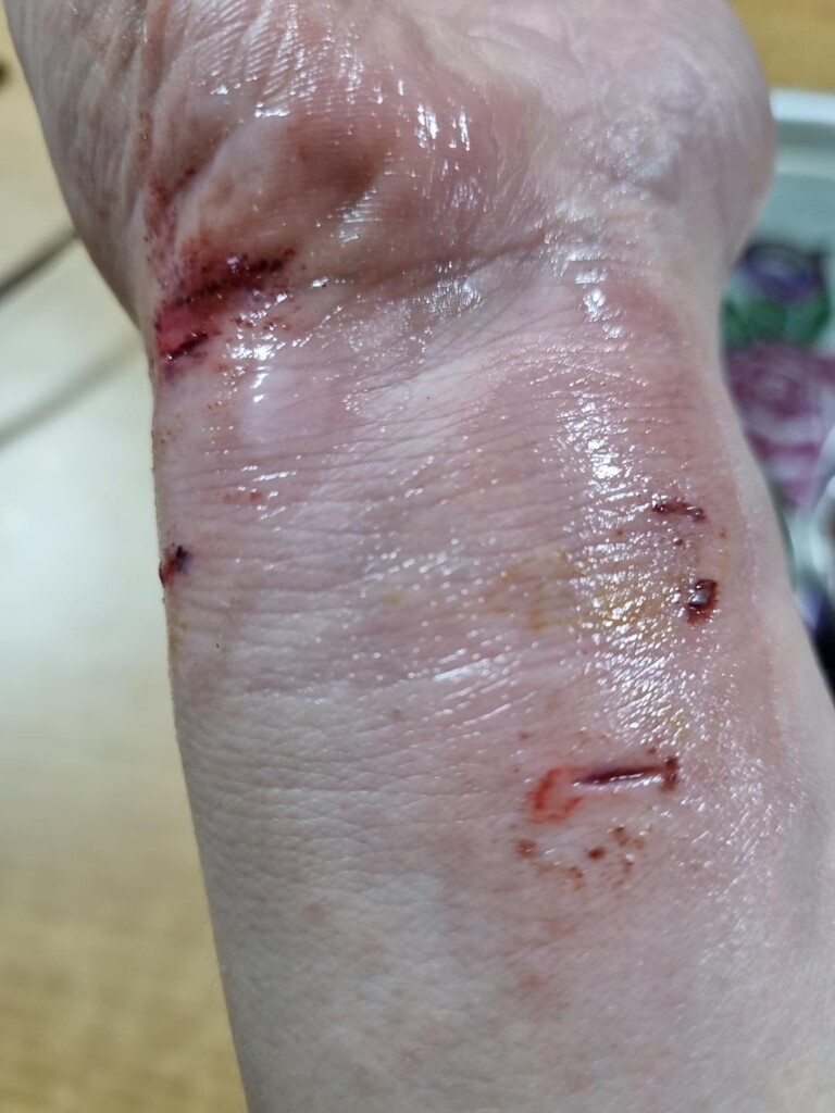 대문 열자 길고양이가 '후다닥'…사람 다쳐도 대책 없어