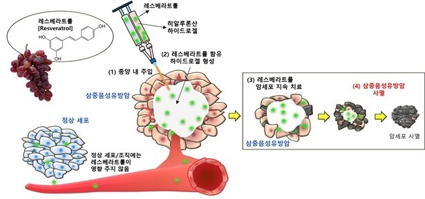 아주대 연구팀 "하이드로겔 활용한 유방암 치료 신기술 개발"