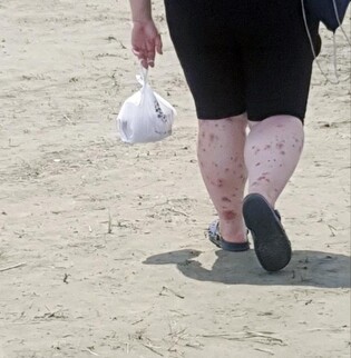 잼버리 학부모들 "아이들 더위·벌레에 힘들어해…일부는 퇴소"